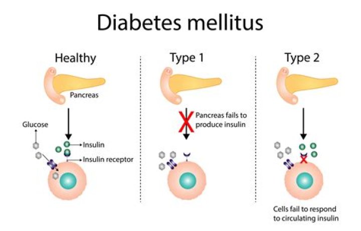 Can you develop diabetes from medication?