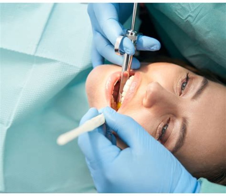 Do dentists charge upfront?