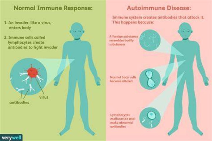 Does an immunologist treat autoimmune diseases?