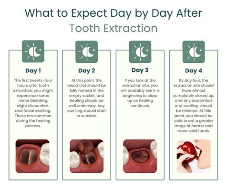 How can I get my teeth pulled for free?