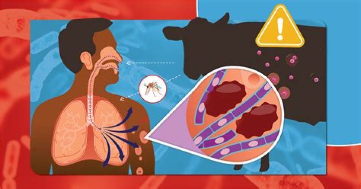 How do you deal with anthrax?