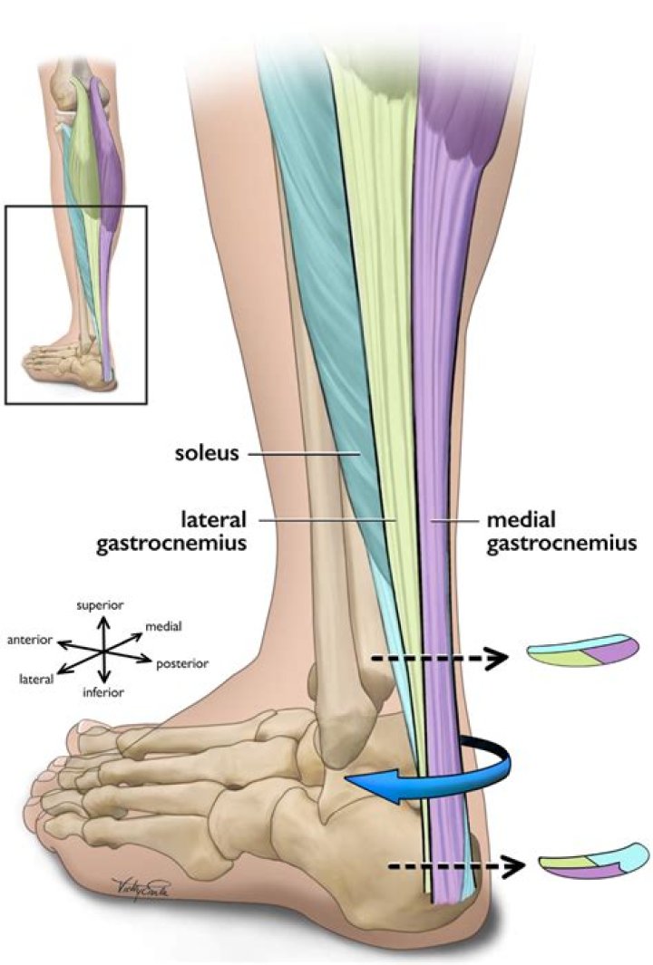 How much is an Achilles tendon worth?