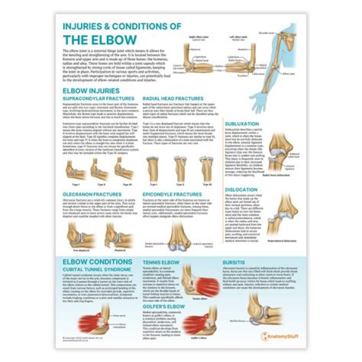 How much is an elbow injury worth?