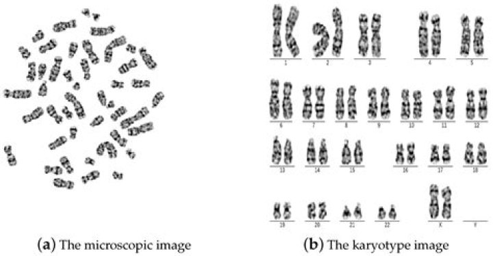 What are 2 methods for obtaining cells for a karyotype?