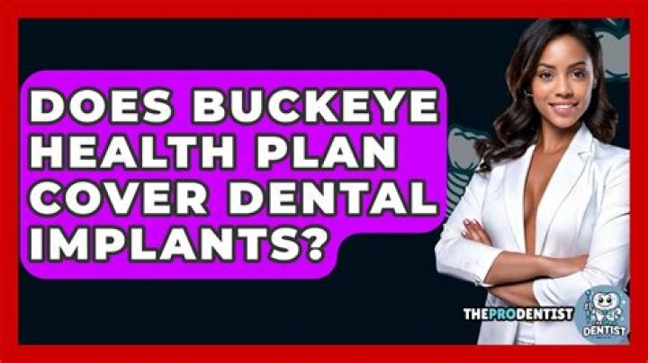 What does Buckeye plan cover?