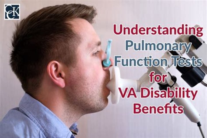 What does the VA count as assets?