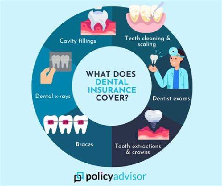 What does typical dental insurance cover?